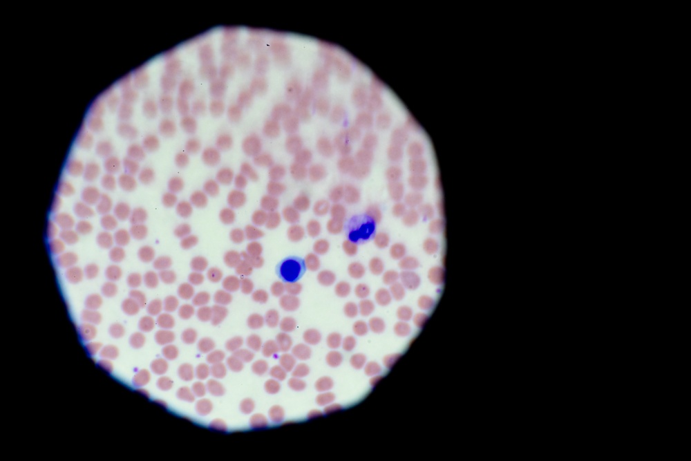 NeoGenomics Pays $9.8M to Settle Kickback and Stark Law Claims Over Below-Cost Lab Consulting